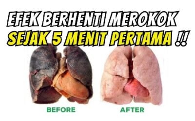 manfaat berhenti merokok